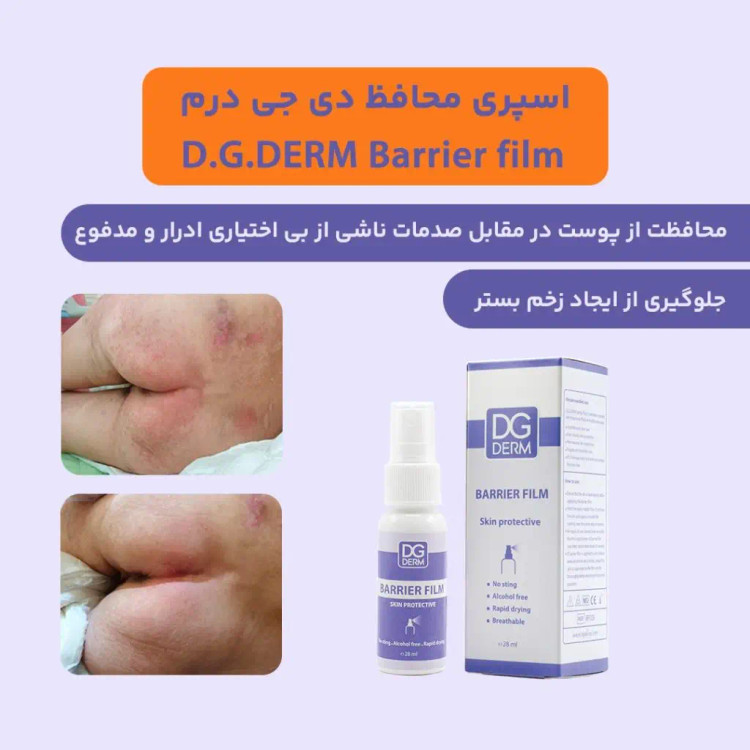 اسپری محافظ پوست دی جی درم